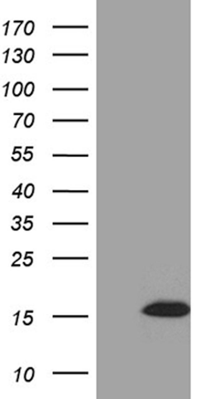 STH Antibody in Western Blot (WB)