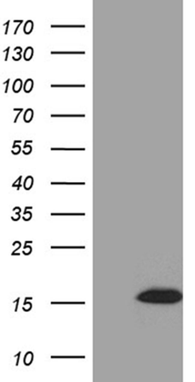 STH Antibody in Western Blot (WB)
