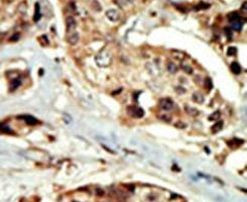 STK16 Antibody in Immunohistochemistry (IHC)