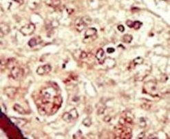STK16 Antibody in Immunohistochemistry (IHC)