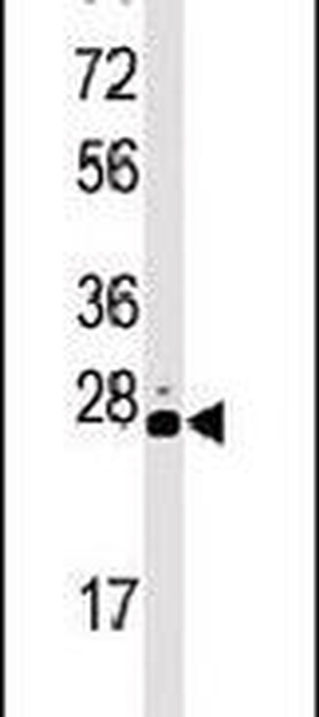 STK19 Antibody in Western Blot (WB)