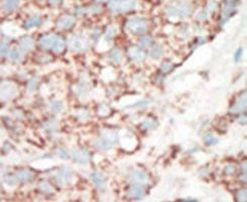 STK25 Antibody in Immunohistochemistry (IHC)