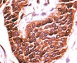 STK29 Antibody in Immunohistochemistry (IHC)