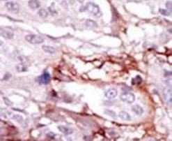 STK31 Antibody in Immunohistochemistry (IHC)