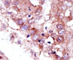 STK33 Antibody in Immunohistochemistry (IHC)