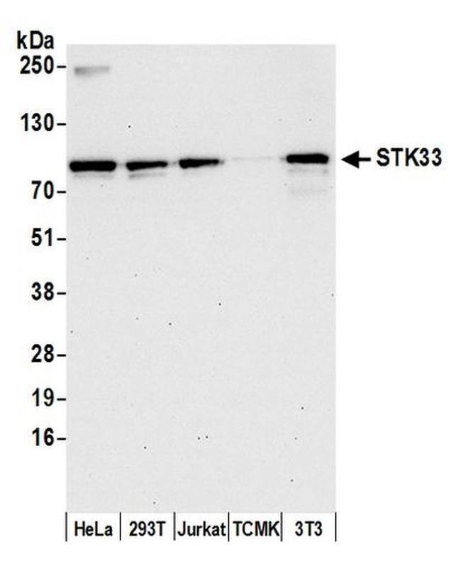 STK33 Antibody in Western Blot (WB)