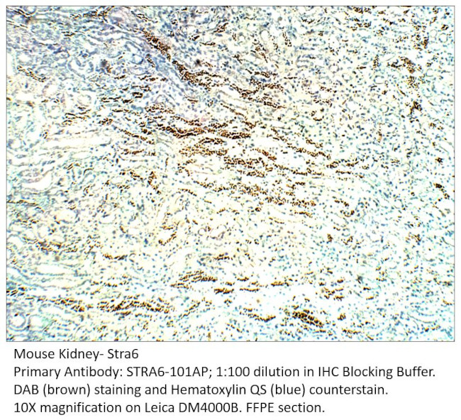 Stra6 Antibody in Immunohistochemistry (IHC)