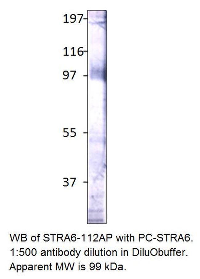 Stra6 Antibody in Western Blot (WB)