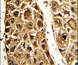 STRA6 Antibody in Immunohistochemistry (IHC)