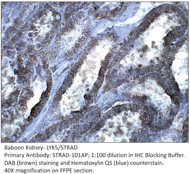 LYK5 Antibody in Immunohistochemistry (IHC)