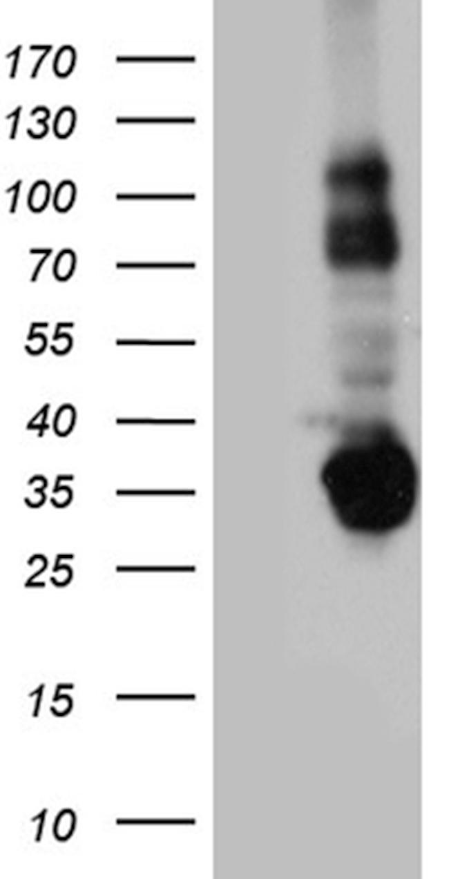 STX3 Antibody in Western Blot (WB)