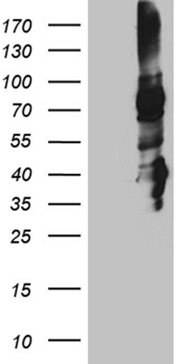 STX3 Antibody in Western Blot (WB)