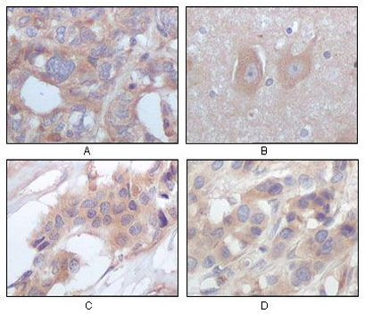 STYK1 Antibody in Immunohistochemistry (Paraffin) (IHC (P))