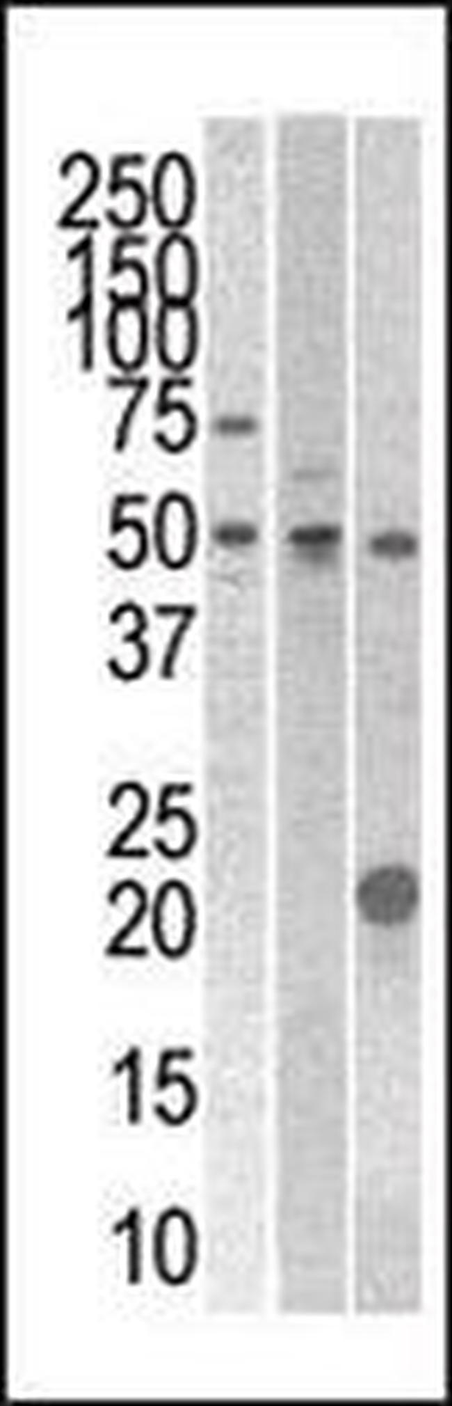 STYK1 Antibody in Western Blot (WB)