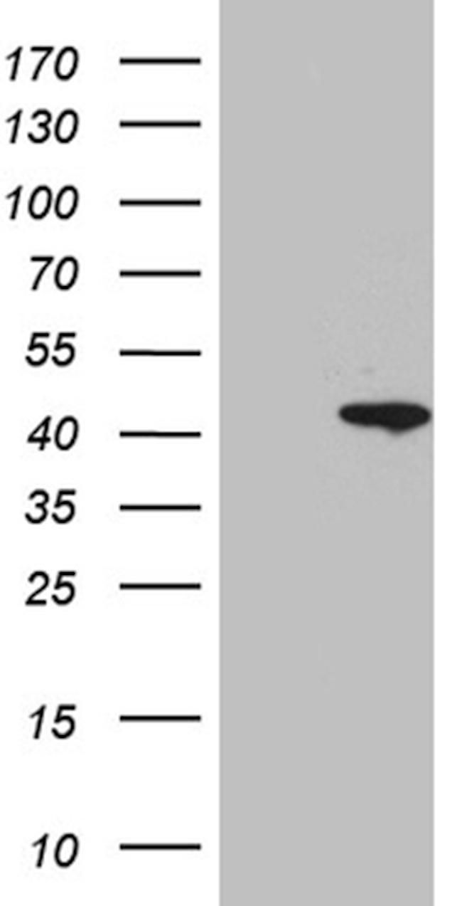 SUGT1 Antibody in Western Blot (WB)