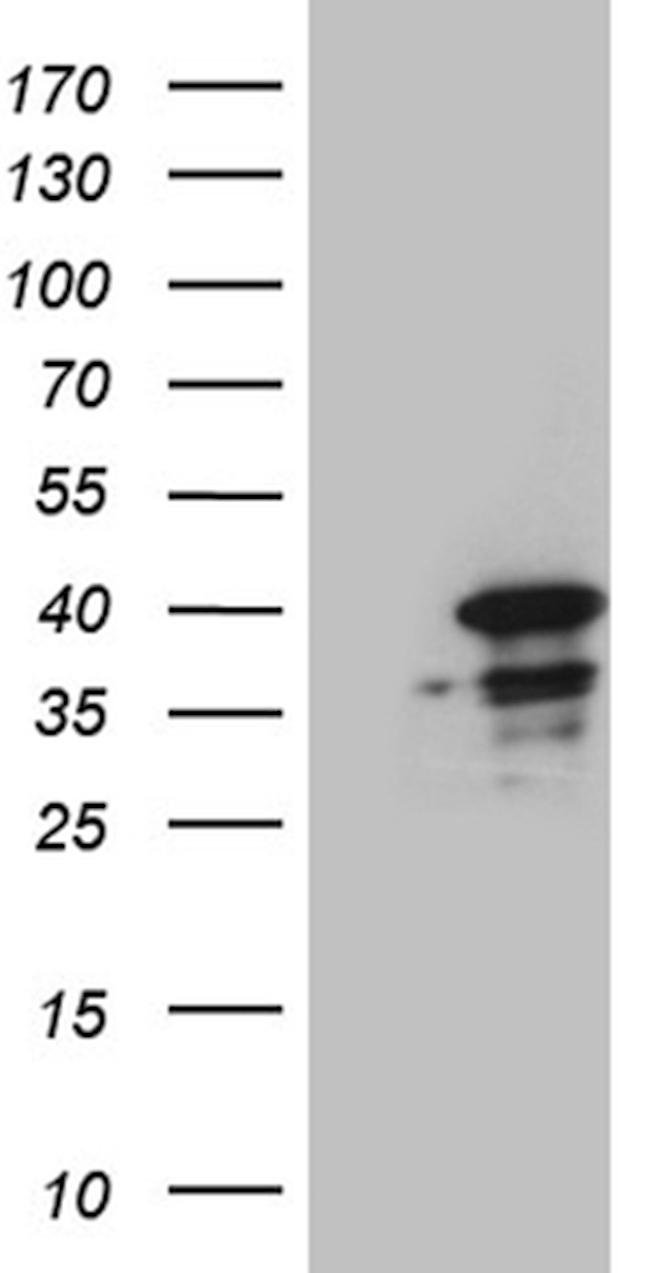 SUGT1 Antibody in Western Blot (WB)
