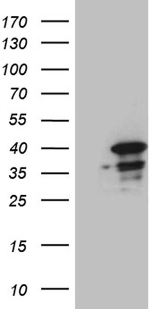 SUGT1 Antibody in Western Blot (WB)