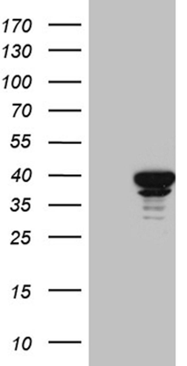SUGT1 Antibody in Western Blot (WB)