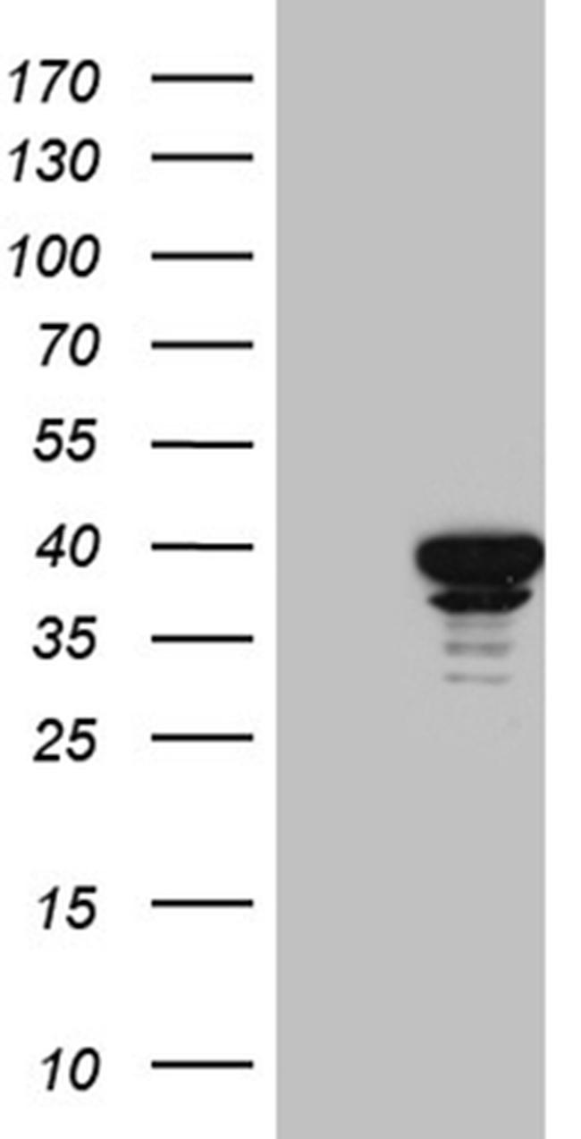 SUGT1 Antibody in Western Blot (WB)
