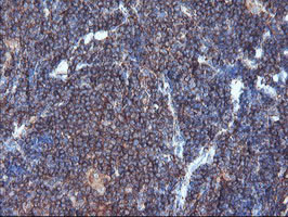 SULT1A1 Antibody in Immunohistochemistry (Paraffin) (IHC (P))