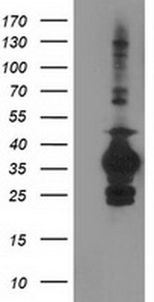 SULT1C2 Antibody in Western Blot (WB)