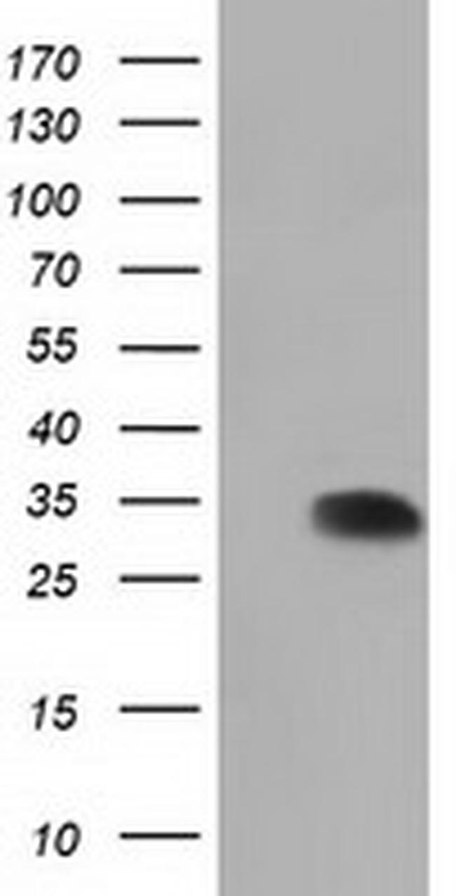 SULT2A1 Antibody in Western Blot (WB)