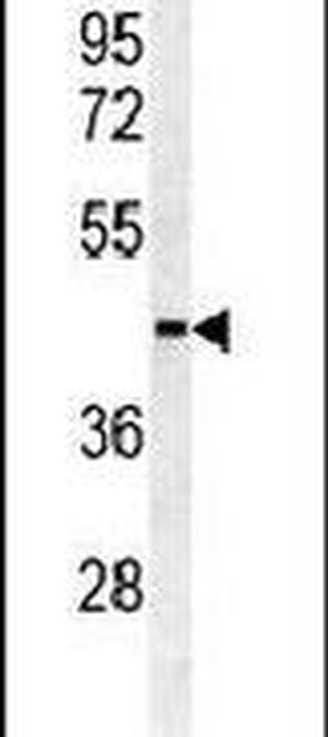 SULT2B1 Antibody in Western Blot (WB)