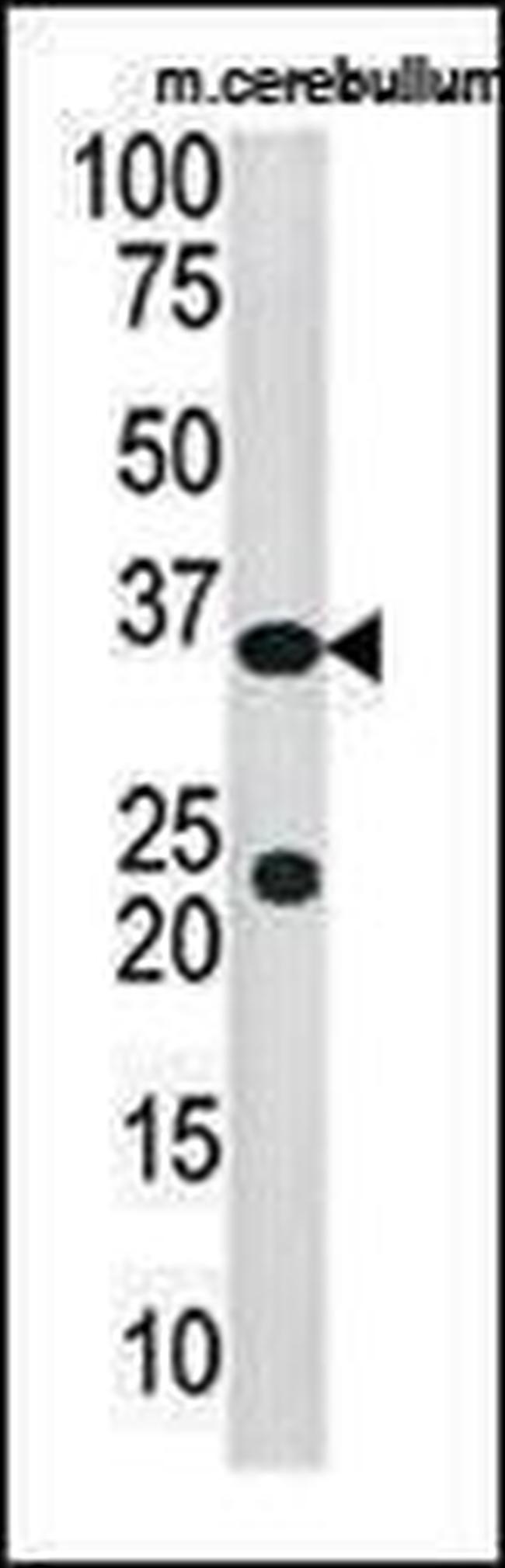 SULT4A1 Antibody in Western Blot (WB)