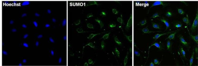 SUMO1 Antibody in Immunocytochemistry (ICC/IF)
