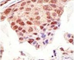 SUMO1 Antibody in Immunohistochemistry (IHC)