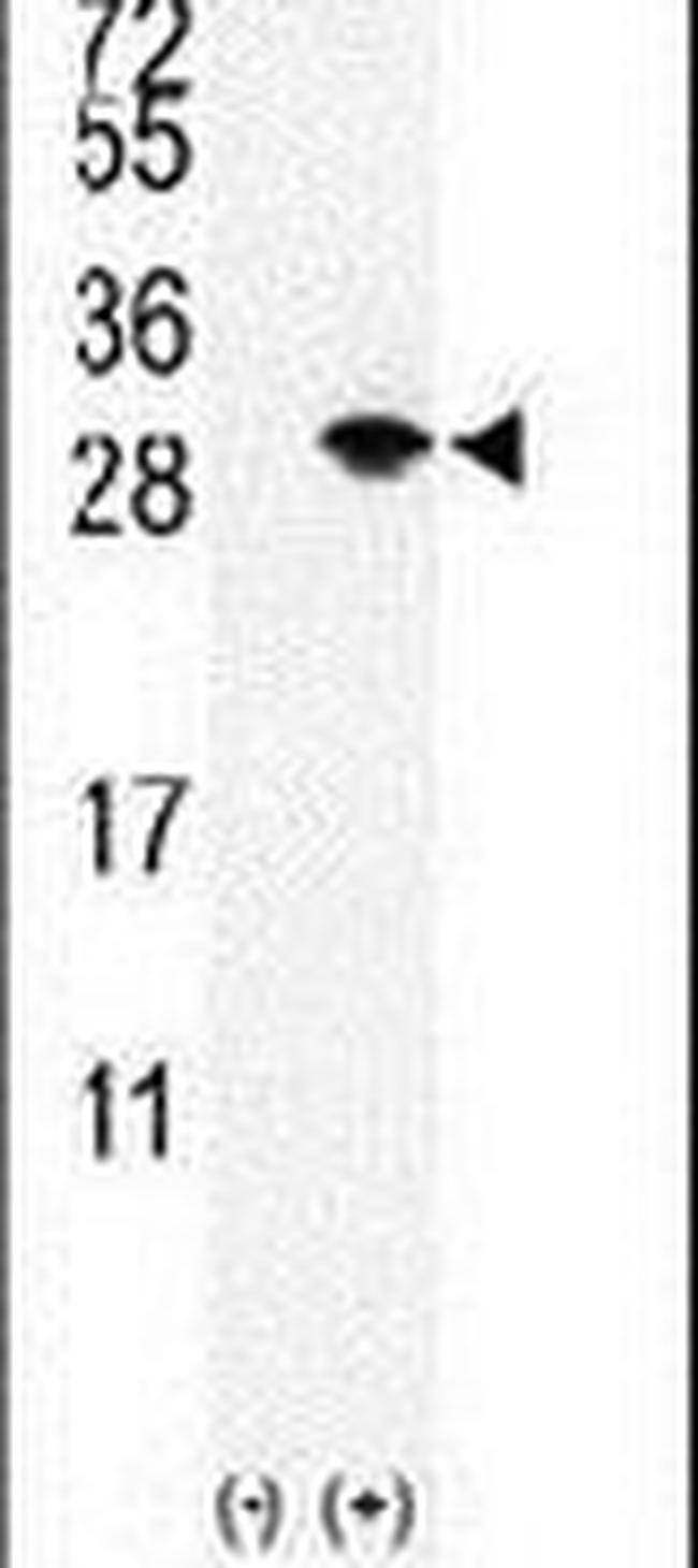 SUMO2/SUMO3 Antibody in Western Blot (WB)