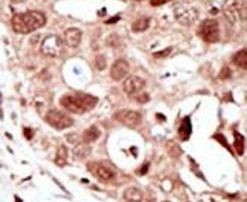 SUMO2 Antibody in Immunohistochemistry (IHC)