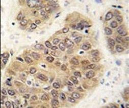 SUMO4 Antibody in Immunohistochemistry (IHC)