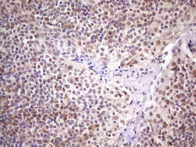 SUPT3H Antibody in Immunohistochemistry (Paraffin) (IHC (P))