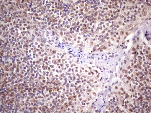 SUPT3H Antibody in Immunohistochemistry (Paraffin) (IHC (P))