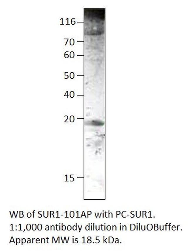SUR1 Antibody in Western Blot (WB)