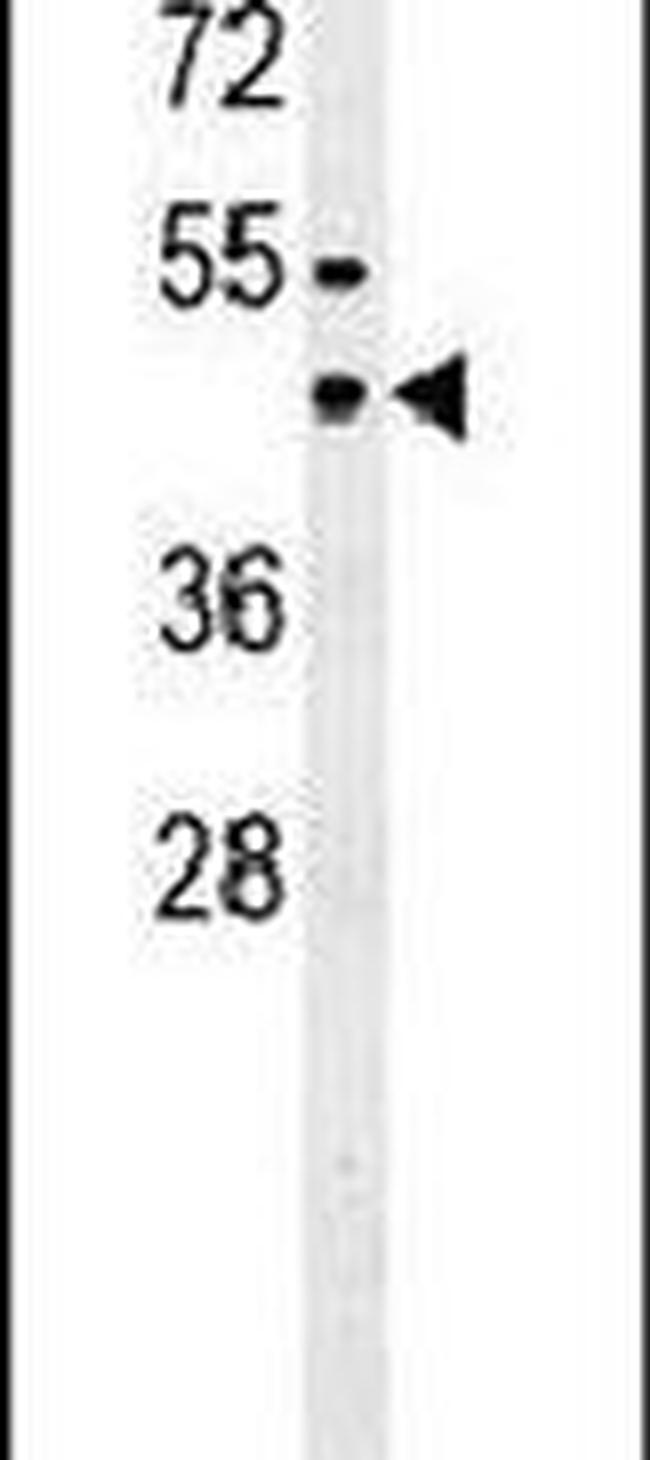 SUV39H1 Antibody in Western Blot (WB)