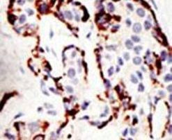 SUV39H2 Antibody in Immunohistochemistry (IHC)