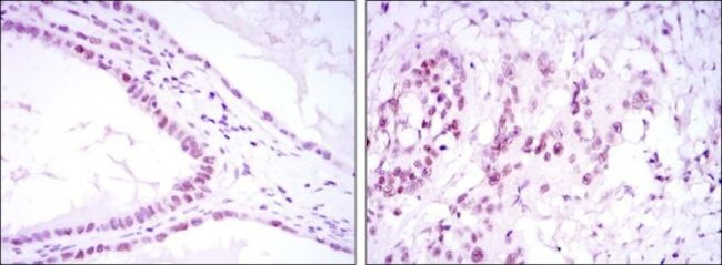 SUZ12 Antibody in Immunohistochemistry (Paraffin) (IHC (P))