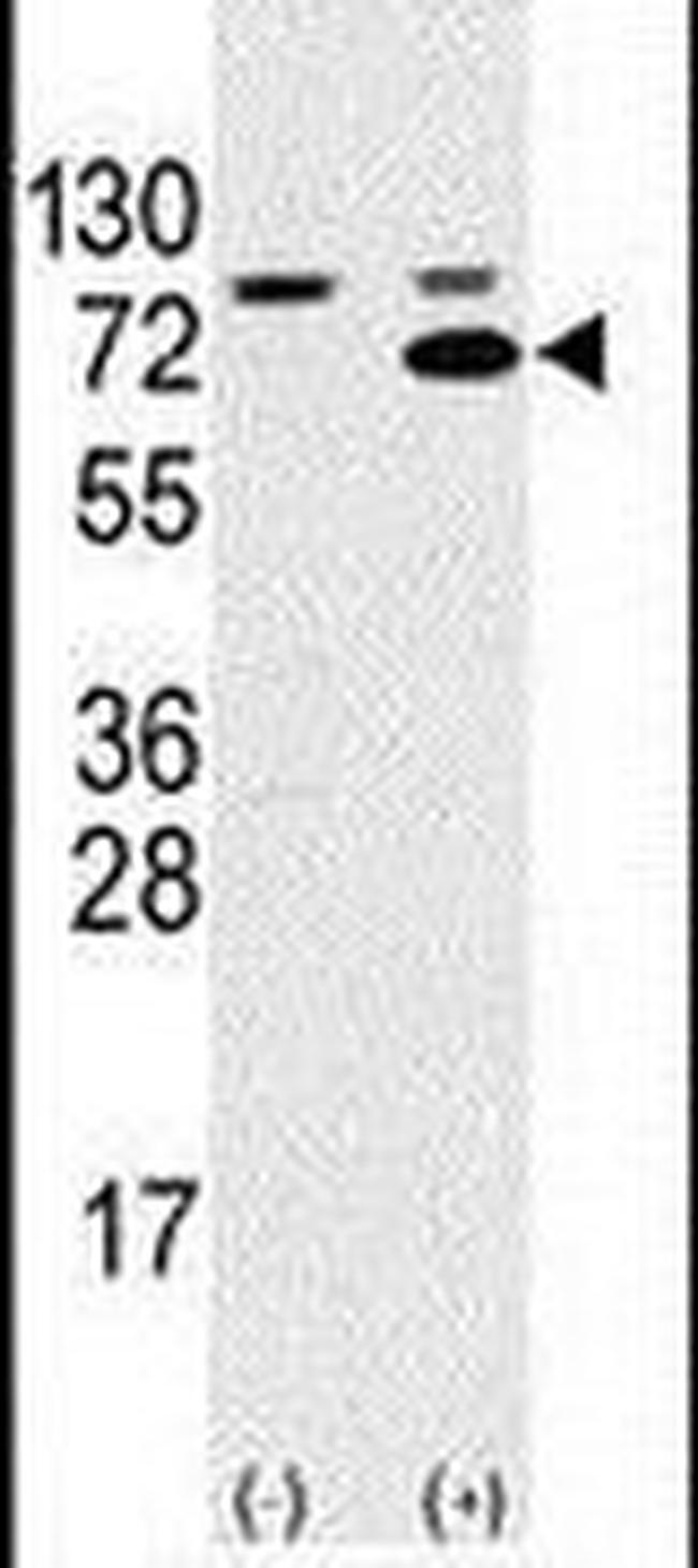 SWAP70 Antibody in Western Blot (WB)