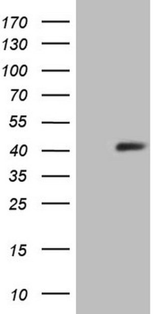 SYCP3 Antibody in Western Blot (WB)