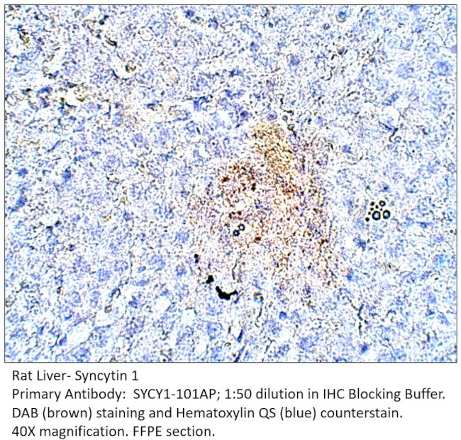 Syncytin 1 Antibody in Immunohistochemistry (IHC)