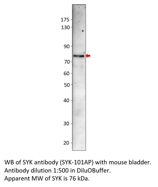 Syk Antibody in Western Blot (WB)