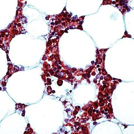 Syk Antibody in Immunohistochemistry (IHC)