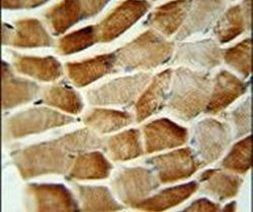 SYNC Antibody in Immunohistochemistry (IHC)