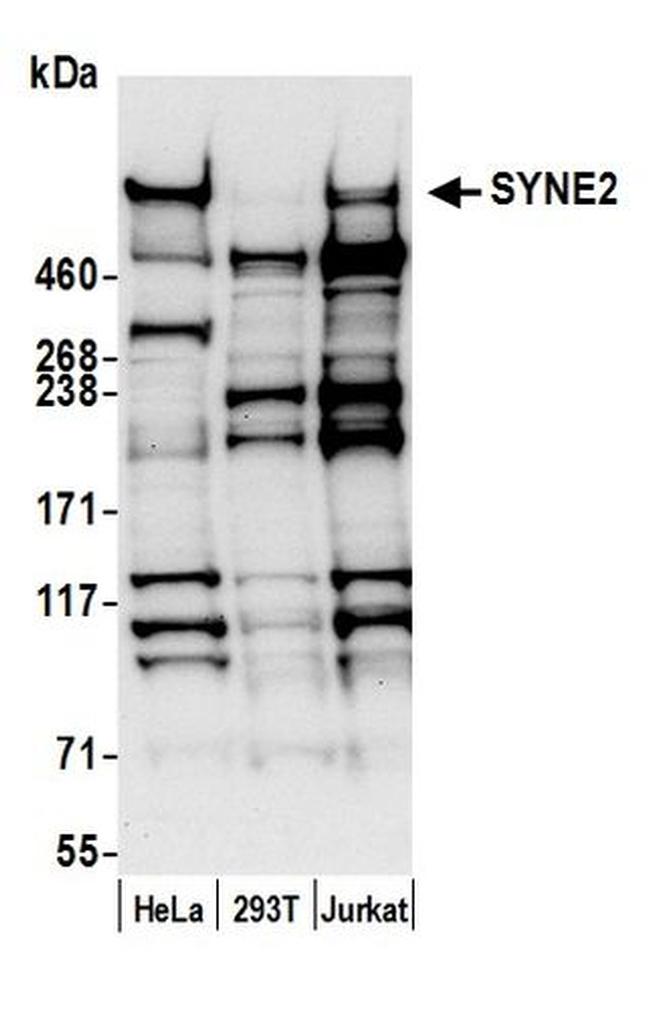 SYNE2/Nesprin 2 Antibody in Western Blot (WB)