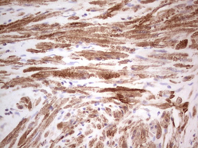 SYNM Antibody in Immunohistochemistry (Paraffin) (IHC (P))