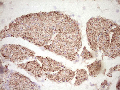 SYNM Antibody in Immunohistochemistry (Paraffin) (IHC (P))