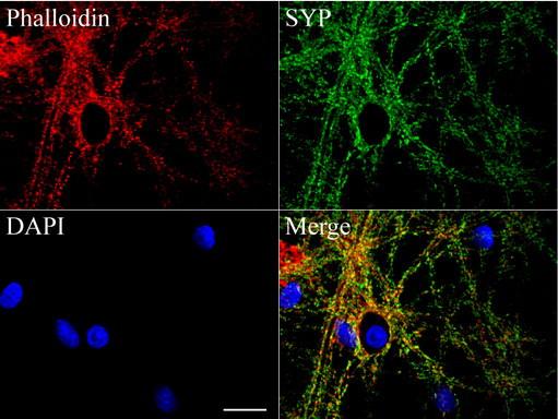 SYP Antibody in Immunocytochemistry (ICC/IF)