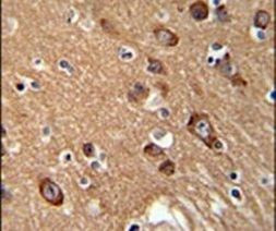 SYT13 Antibody in Immunohistochemistry (IHC)